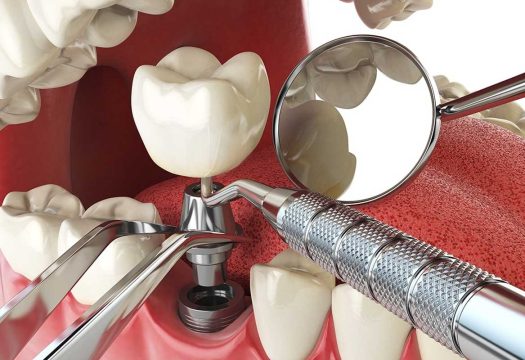dental